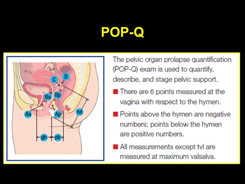 POP-Q